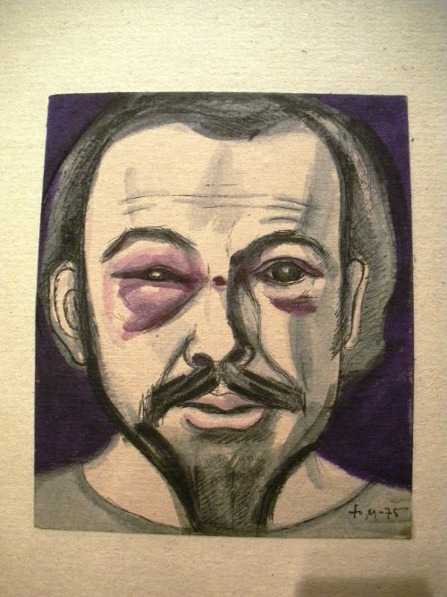 Self-Portrait with Black Eye